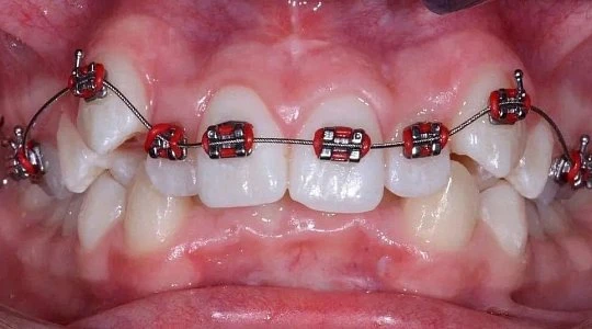 До лечения